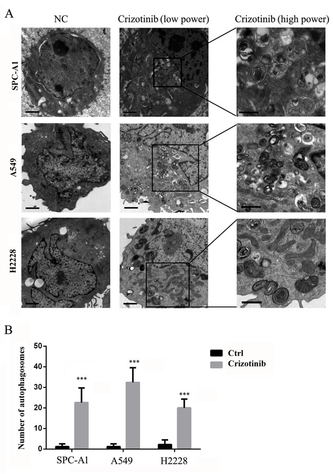 TEM depicts the ultrastructures of autophagosomes in cells treated with crizotinib.