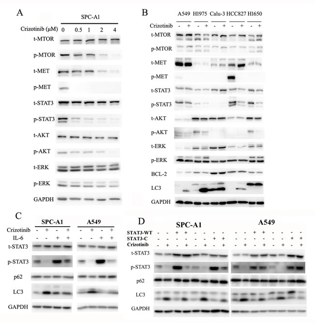 Crizotinib induces autophagy through the inhibition of STAT3.