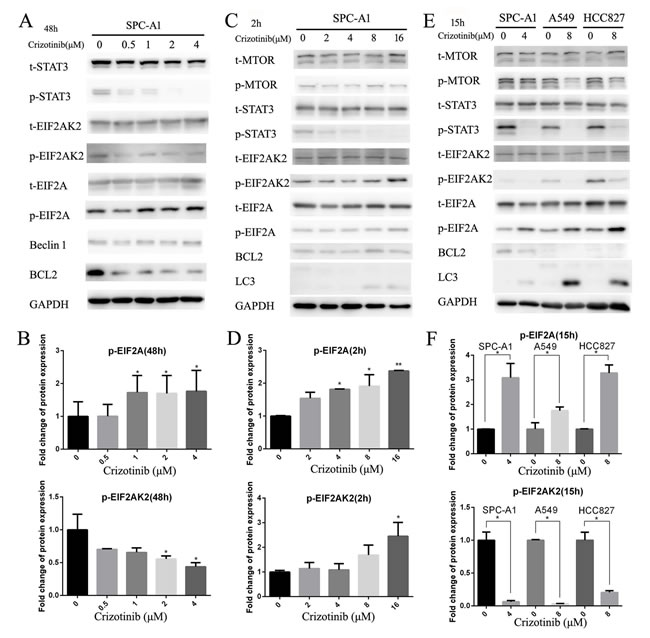 Inhibition of cytoplasmic and nuclear STAT3 pathways both participated in crizotinib-induced autophagy.