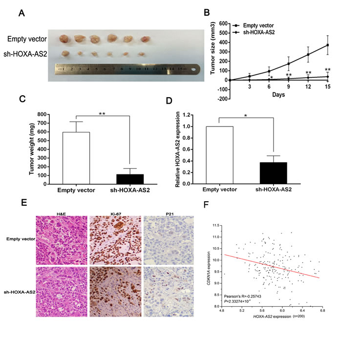 HOXA-AS2 promotes tumorigenesis of GC cells