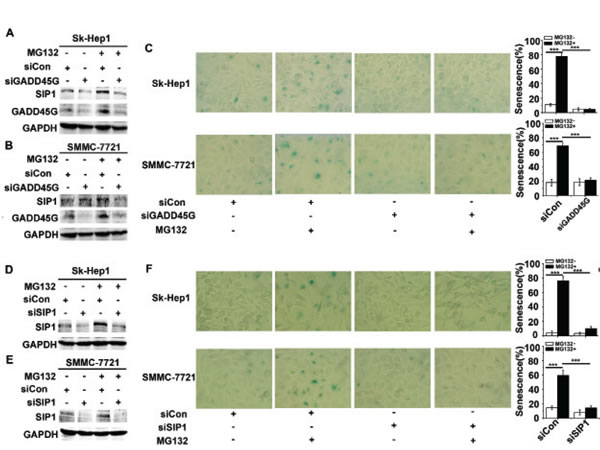 GADD45G and SIP1 are required for the proteasome inhibitor MG132-induced tumor cell senescence.