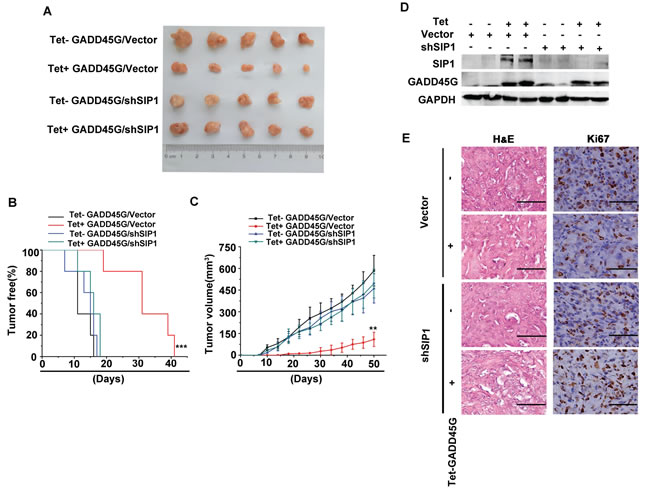 SIP1 inhibition attenuates GADD45G-mediated inhibition of tumor growth