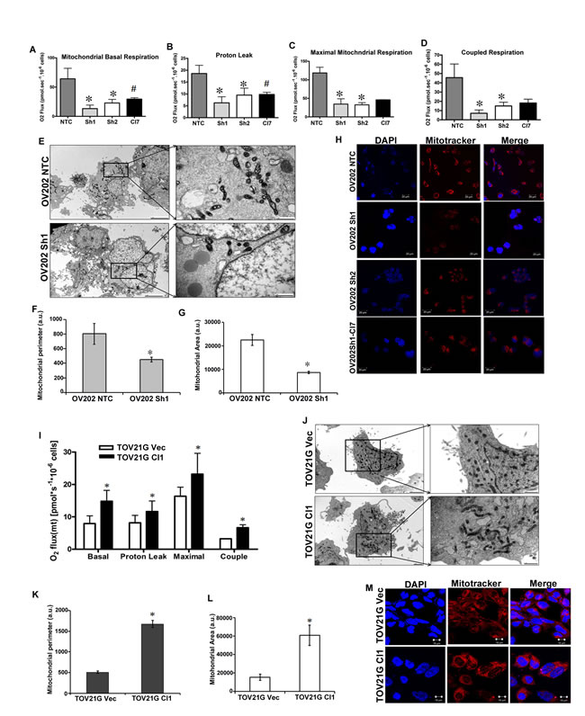 HSulf-1 is associated with reduced OXPHOS and impaired mitochondria.