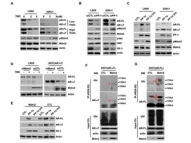 PP-1 regulates AR-FL and AR-v7 protein stability through Mdm2 ubiquitin ligase.