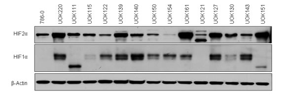 Characterization of the HIF&#945; status of CCRCC cells.