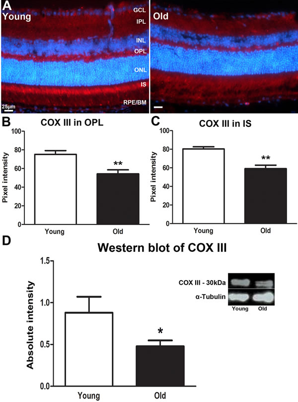 Changes in levels of mitochondrial cytochrome C oxidase III proteins in the ageing retina of C57BL/6 mice.
