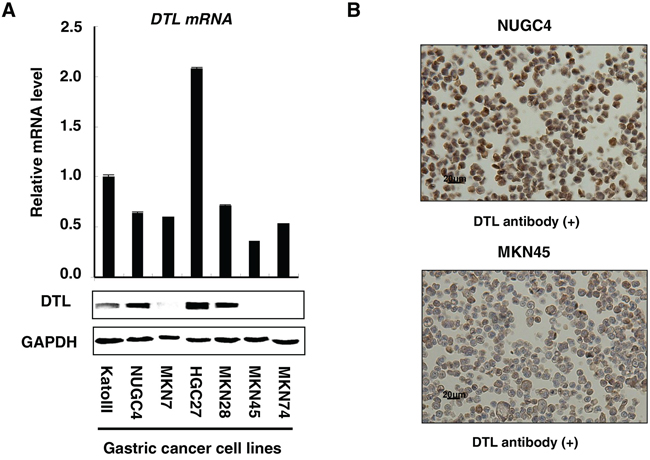 Expression profiles of DTL in 7 GC cell lines.