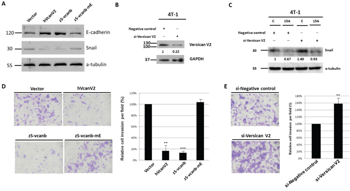 Versican V2 inhibits cancer cell invasion and metastasis.