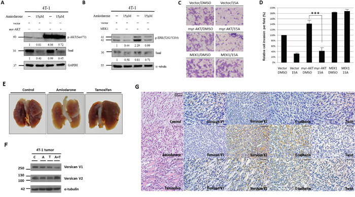 Amiodarone represses Snail protein expression through the ERK pathway and block metastatic properties in vivo.