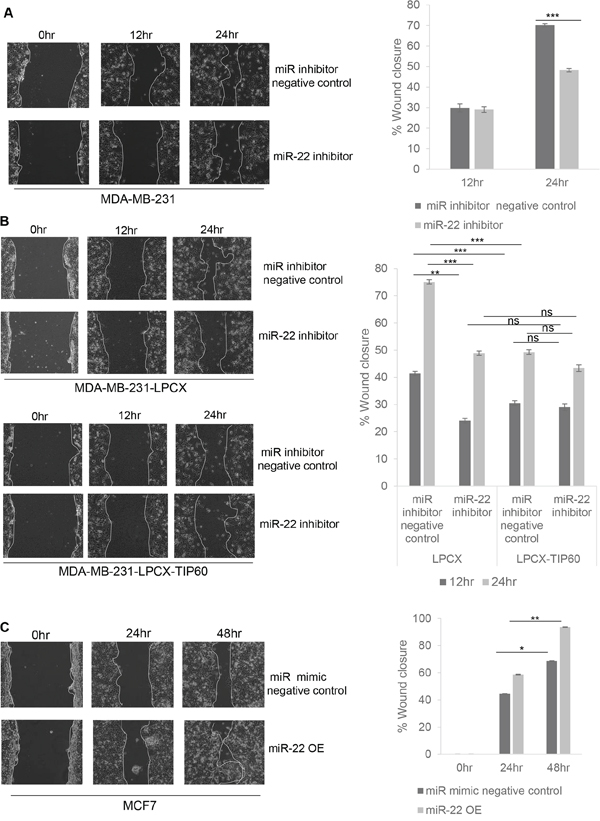 miR-22 increases cell migration by targeting expression of TIP60.