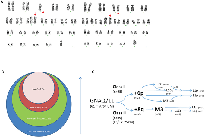 Chronology of genomic imbalances in UM development.