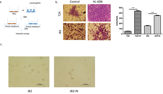 Neutrophils could promote BCa invasion.