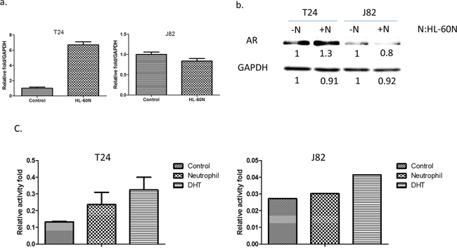 BCa cells express higher level/activity of androgen receptor (AR) after co-culturing with HL-60N.