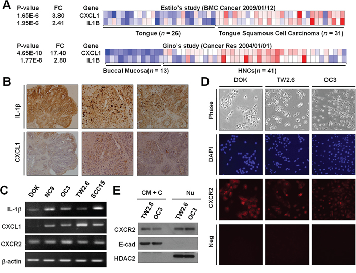 Expression of IL-1&#x03B2;, CXCL1, and CXCR2 in OSCC.