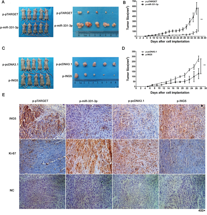 miR-331-3p or ING5 overexpression influences tumor growth in nude mice.