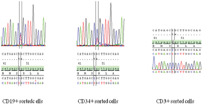 Sequencing results for the different blood fractions showing DNMT3A mutations in all fractions except in the CD3&#x002B; T lymphocyte fraction.