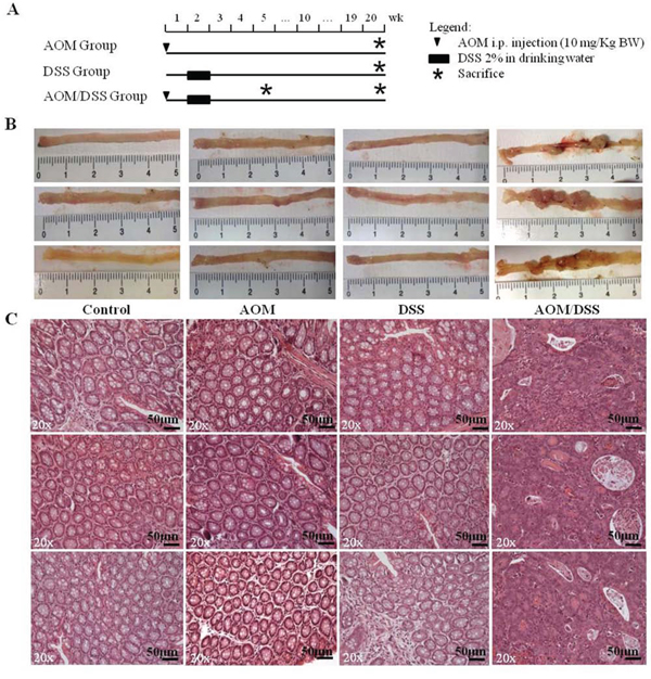 Experimental procedure and macroscopic and histological observation of the AOM/DSS murine model.