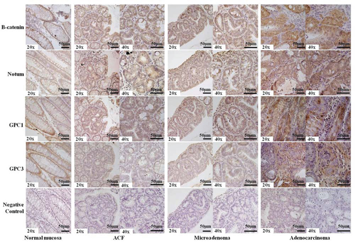 Representative results of immunostaining for &#x03B2;-catenin, Notum, Glypican-1, Glypican-3 in FFPE mouse tissue sections.