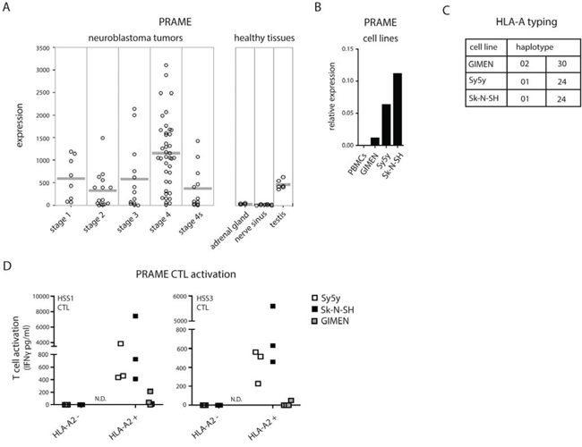 PRAME CTL recognition of neuroblastoma cells.