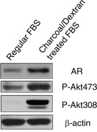 Depletion of androgen increased AR expression and Akt activity.