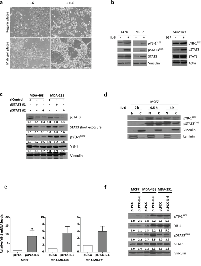 IL-6 induces YB-1 phosphorylation in MCF7 cells.