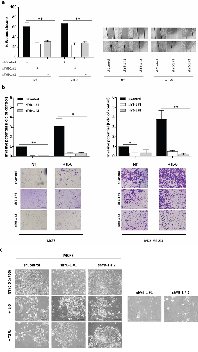 YB-1 is involved in the IL-6&#x2013;induced metastatic phenotype.