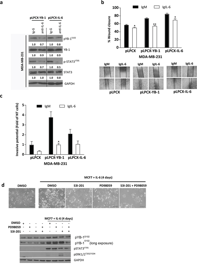 Involvement of IL-6 in YB-1&#x2013;promoted migration and invasion.