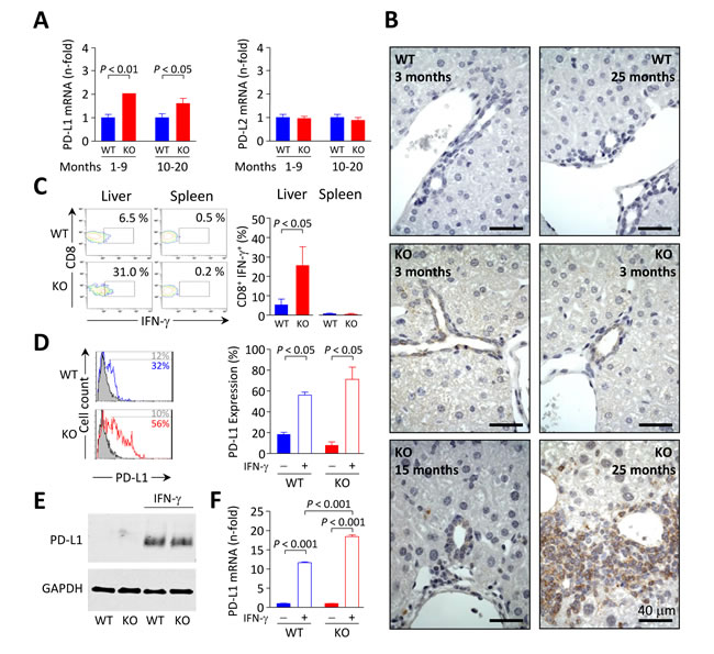 PD-L1 expression in mouse biliary epithelial cells is influenced by IFN-&#x3b3;.