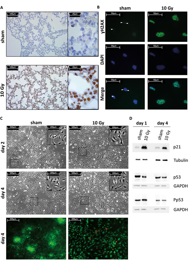 Lung epithelial cells radiation response and senescence markers.