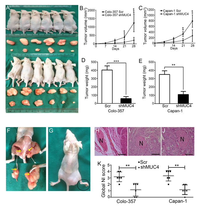 MUC4 knockdown suppresses NI by PDAC cells