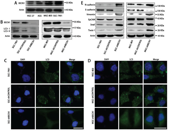 Autophagy inhibition promotes EMT of SGC-7901 and MGC-803 cells.