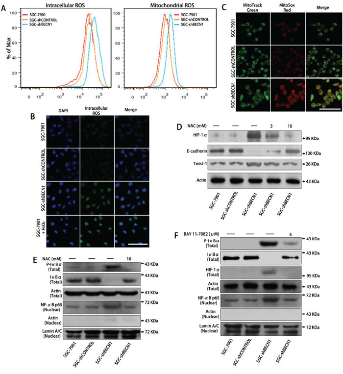 Autophagy defect in gastric cancer cells facilitates HIF-1&#x03B1; expression by ROS-NF-&#x03BA;B-HIF-1&#x03B1; pathway.
