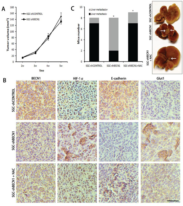Antioxidant NAC reverts autophagy inhibition induced metastasis in vivo.