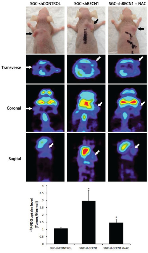 Antioxidant NAC restrains autophagy inhibition induced glycolysis in vivo.