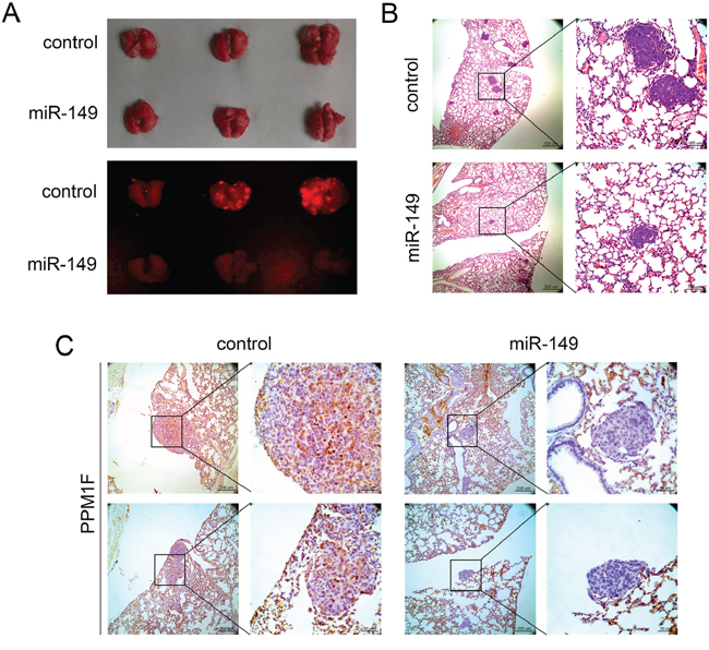 miR-149 suppresses HCC metastasis in vivo.