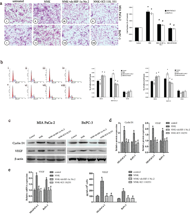 NNK promotes pancreatic cancer proliferation and invasion in vitro through &#x03B2;2-AR signaling.