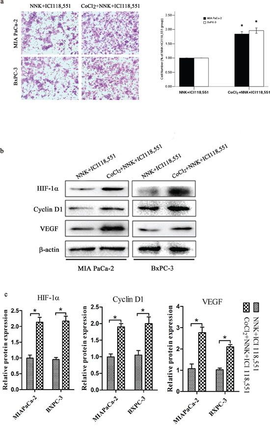 HIF-1&#x03B1; overexpression abolished &#x03B2;2-antagonist-induced effects on pancreatic cancer. Both BxPC-3 and MIAPaCa-2 cells were treated with 150 &#x03BC;M CoCl2 to induce HIF-1&#x03B1; overexpression.