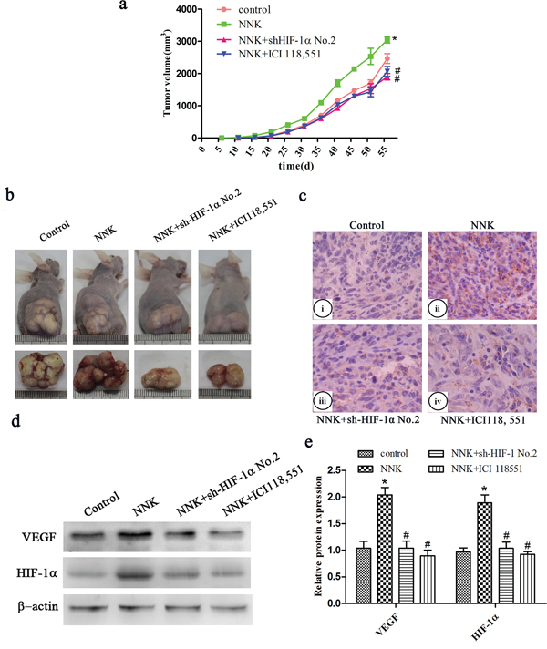 &#x03B2;2-AR signaling regulates NNK-induced tumor growth and VEGF expression in vivo through upregulation of HIF-1&#x03B1;.