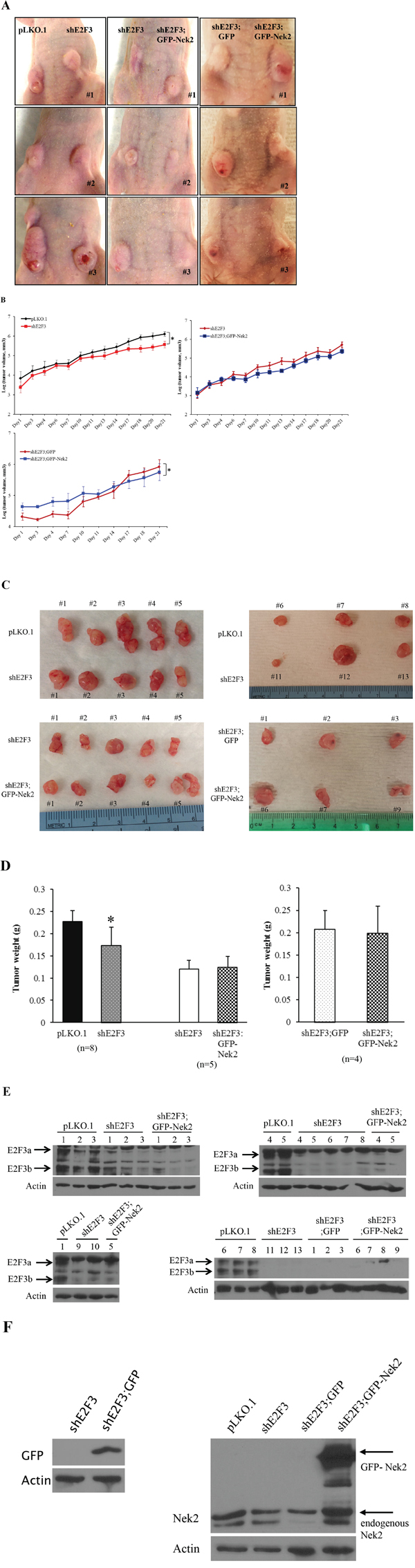 E2F3 knockdown decreases tumor growth and burden of Her2+ HCC1954 cells.