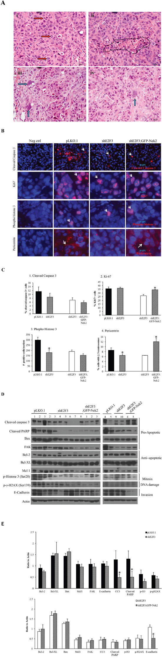 E2F3 knockdown restricts percentage of Her2+ breast tumor cells undergoing mitosis.
