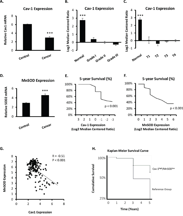 Cav-1 and MnSOD mRNA levels are inversely expressed in human breast cancer patients.