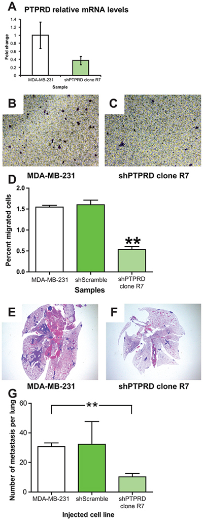 PTPRD knockdown in human breast cancer decreases migration and lung colonization.