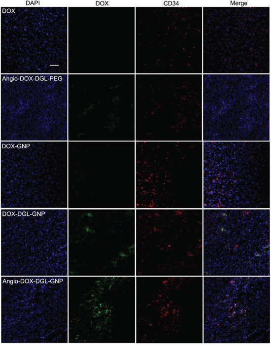 In vivo tumor distribution of DOX, Angio-DOX-DGL-PEG, DOX-GNP, DOX-DGL-GNP and Angio-DOX-DGL-GNP.
