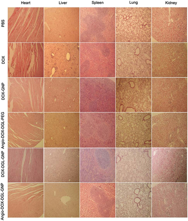 Histological analysis for different organs of 4T1 bearing mice administrated PBS, DOX, Angio-DOX-DGL-PEG, DOX-GNP, DOX-DGL-GNP and Angio-DOX-DGL-GNP (all tissues: &#x00D7; 100).