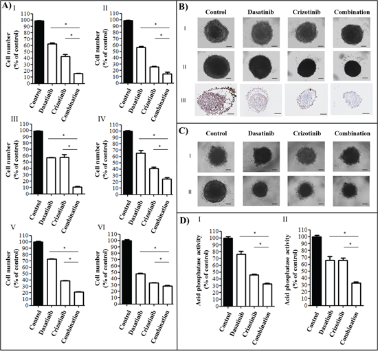 Cytotoxicity of a combination of dasatinib and crizotinib on GBM cell lines and GBM tumor spheroids.