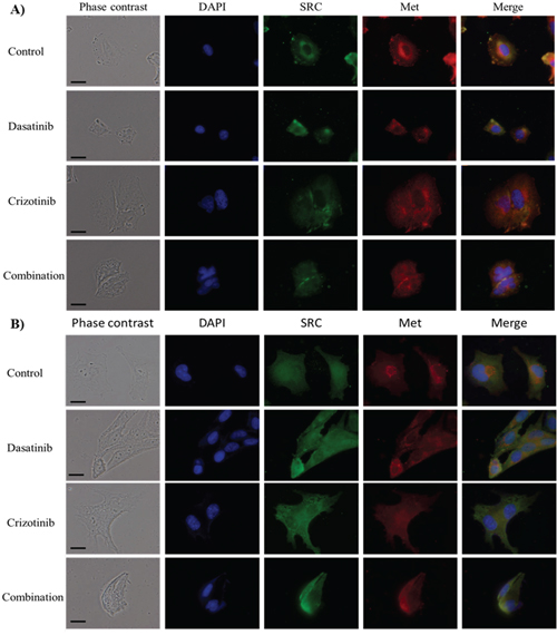 Immunocytochemistry of SRC and Met localization.