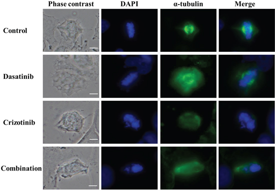 Combination of dasatinib and crizotinib impedes the formation of the &#x03B1;-tubulin-labeled mitotic spindle.