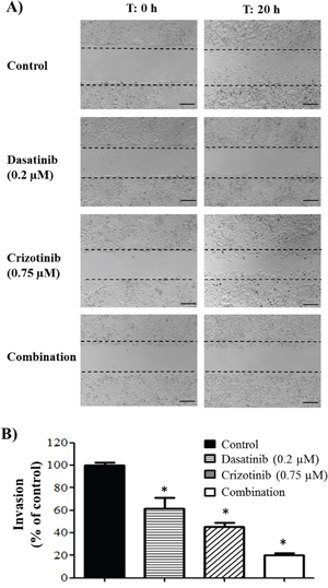 Migration and invasion of GBM cell lines.