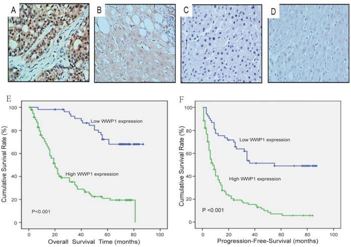 Immunohistochemical analyses of WWP1 protein expression in primary hepatocellular carcinoma surgical specimens and Kaplan&#x2013;Meier survival analyses of the primary HCC patients (n = 149) with high WWP1 expression (n = 95) and low WWP1 expression (n = 54) after resection.