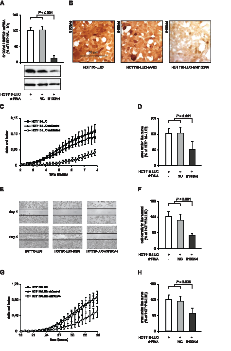 Figure&#160;1:S100A4-shRNA reduces S100A4 expression and cellular motility in HCT116.